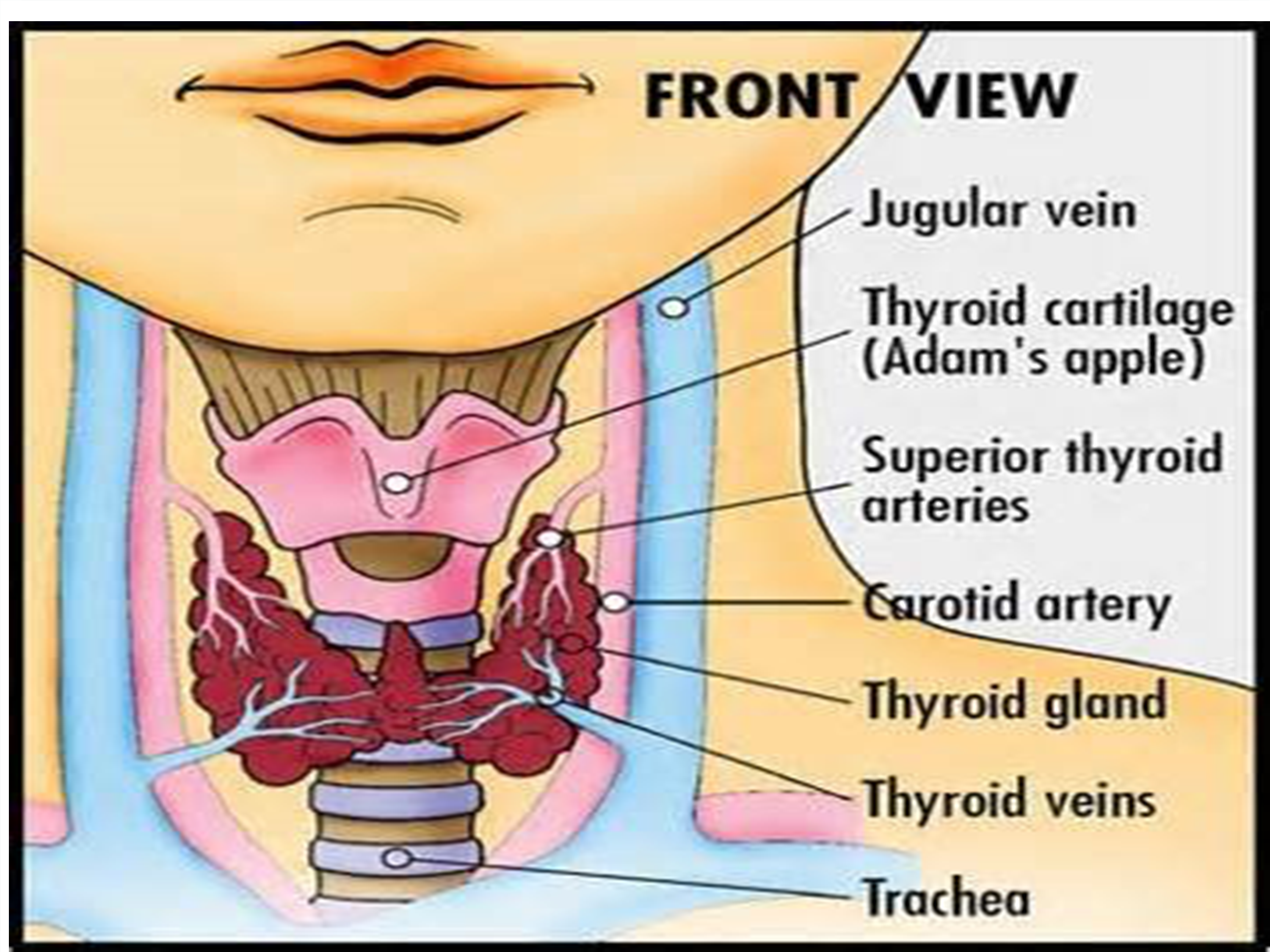 No preview available