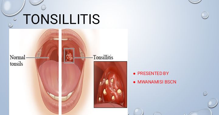 No preview available